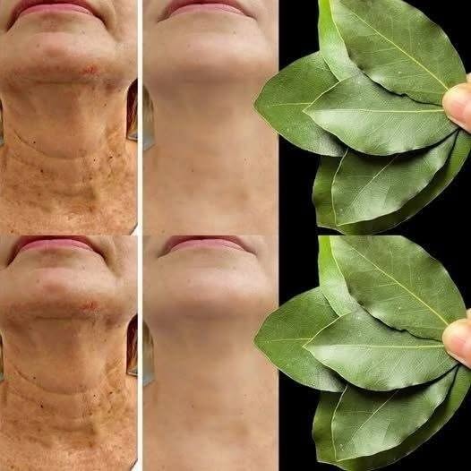 Bay Leaf Beauty Ritual: A Natural DIY Toner for Smoother Skin
